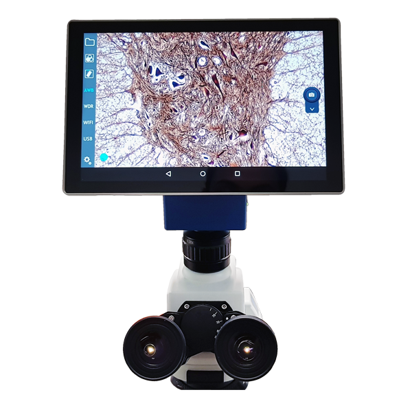 VE-300PAD Biological Binocular Microscope w/ 10.1" Integrated Tablet and 4.0 MP Digital Camera
